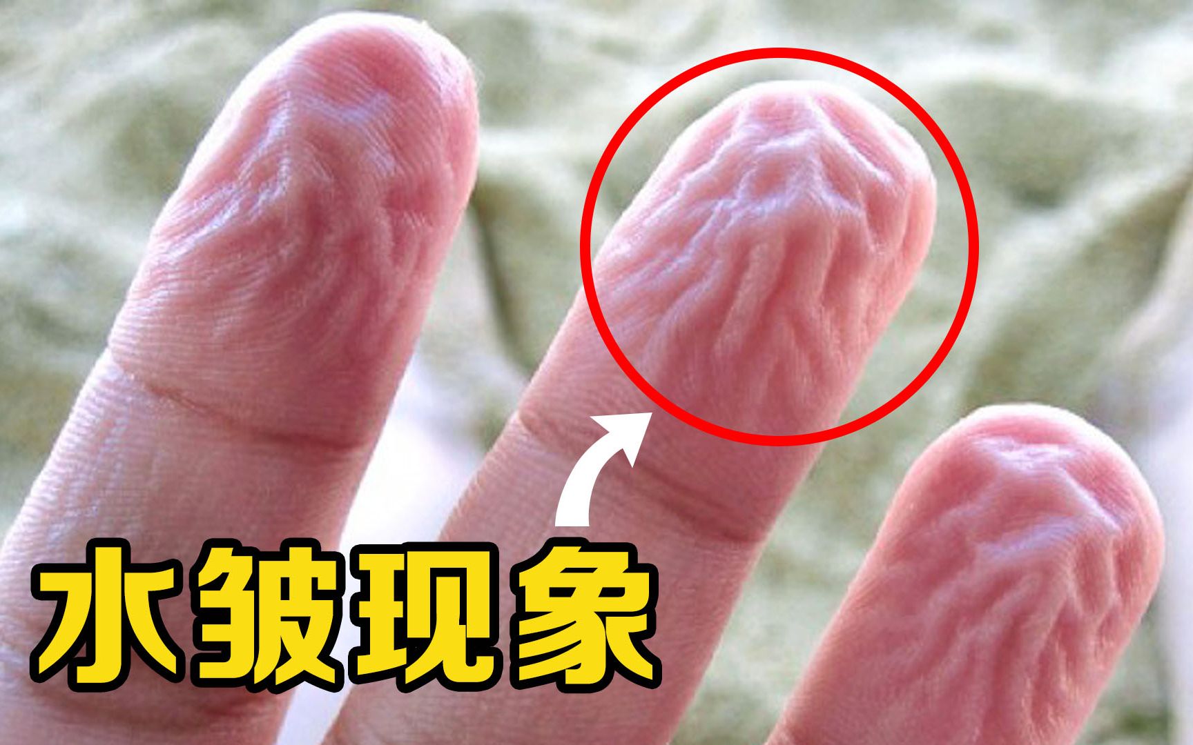 有趣的人体冷知识，为什么手指泡久了会“皱巴巴”，其他部位却没有？
